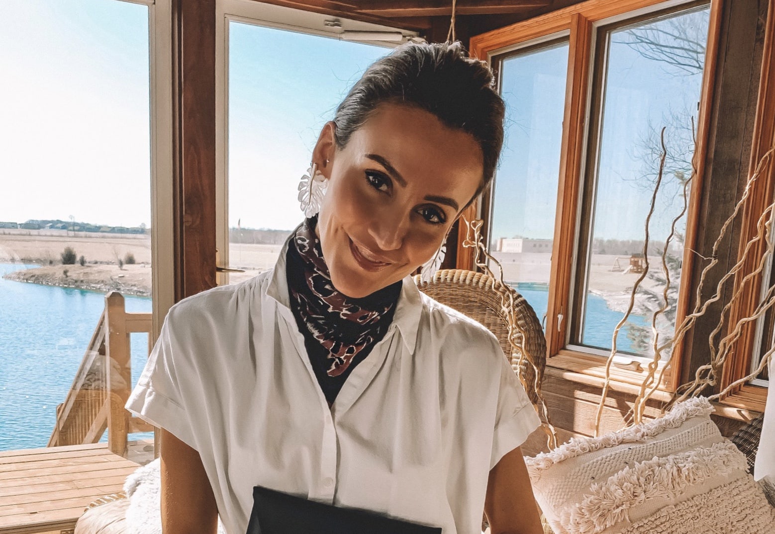 Melasma Treatment For The Best Skin Of Your Life Karina Style Diaries